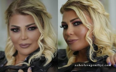 “Ağzında bir dişi var, mənə elçi düşüb” - Video