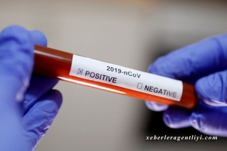 Azərbaycanda 50 nəfər koronavirusa yoluxdu, 1 nəfər vəfat etdi