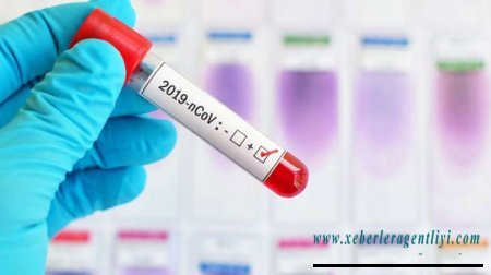 Azərbaycanda daha 39 nəfər koronavirusa yoluxub, 59 nəfər sağalıb