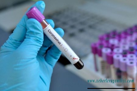 Azərbaycanda daha 40 nəfərdə koronavirus aşkarlandı - RƏSMİ