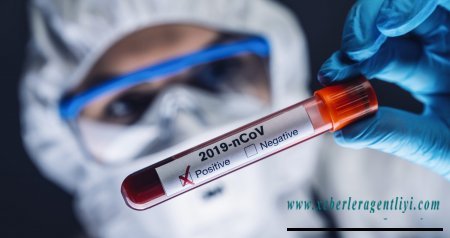 Azərbaycanda daha 325 nəfər koronavirusa yoluxub, 5 nəfər ölüb