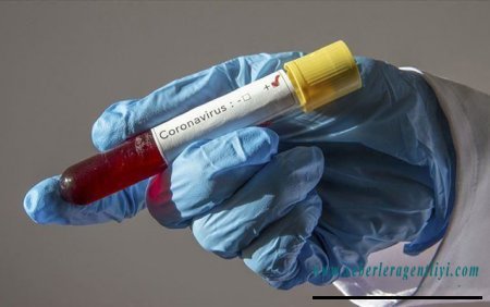 Daha 262 nəfər koronavirusa yoluxdu - 2 nəfər öldü