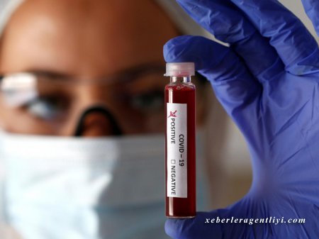 Daha 323 nəfərdə koronavirus aşkarlandı - 5 nəfər vəfat etdi