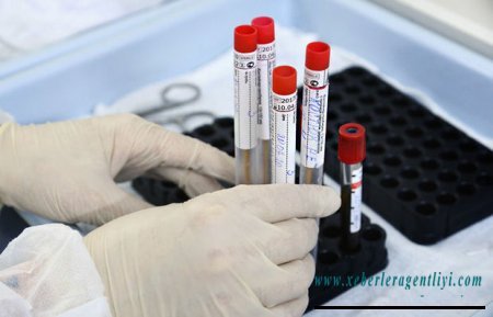 Azərbaycanda koronavirus ilə bağlı son vəziyyət açıqlandı