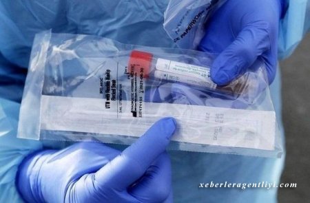 Bakıda xəstəxanada 33 tibb işçisi koronavirusa yoluxdu - ÖZƏL