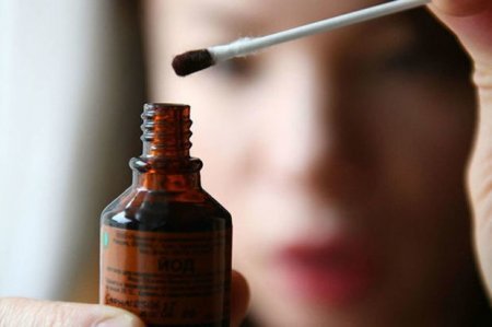 Həkimlər yodun bilinməyən zərərlərindən danışdılar - VİDEO