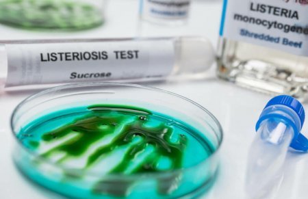 ABŞ-də epidemiya: daha 28 nəfər təhlükəli xəstəliyə yoluxdu